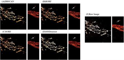 MSDenoiser: Muti-step adaptive denoising framework for super-resolution image from single molecule localization microscopy